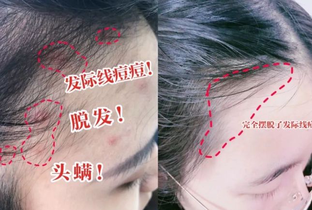 吹干好？10分钟轻松养成女明星「绸缎发」mg不朽情缘游戏试玩洗完头自然风干还是(图17)